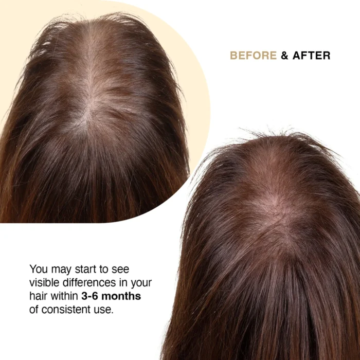 Capillus Hair Supplement - Image 3