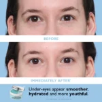 Peter Thomas Roth Full-Size Vitamin C & Hyaluronic Eye Patches Duo - Image 6