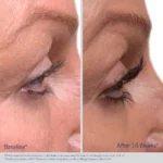 Obagi Nu-Cil® Eyelash Boosting Serum - Image 3