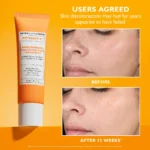 Peter Thomas Roth Potent-C Niacinamide Discoloration Treatment - Image 2