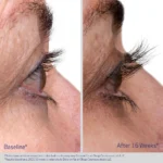 Obagi Nu-Cil® Eyelash Boosting Serum - Image 2