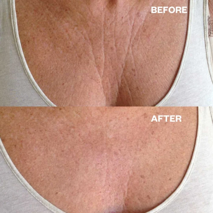 Wrinkles Schminkles Chest Wrinkle Patch - Image 4