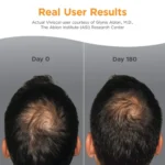 Viviscal Men's Hair Growth Supplements - Image 2