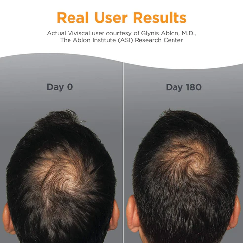 ManHairGrowthSupplements2 Viviscal Men's Hair Growth Supplements - Image 2