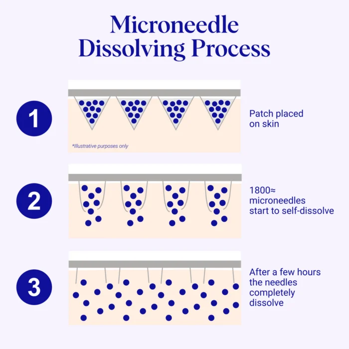 Wrinkles Schminkles Self-Dissolving Microneedle Patches - Image 7