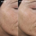 IMAGE Skincare AGELESS+ retinol pure liquid retinol 0.3% - Image 7