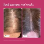 Viviscal™ Hair Growth Supplements - Image 8