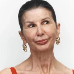 Wrinkles Schminkles Mouth & Lip Wrinkle Patches - Image 4