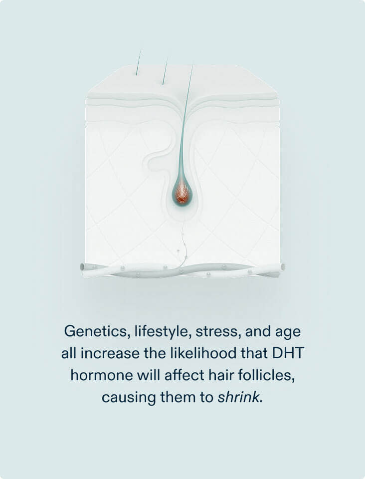 men-dht-duo-root-causes Nutrafol Men + DHT Inhibitor - Image 3