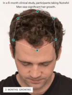 Nutrafol Men’s Fullest Hair Kit - Image 4