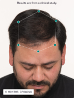 Nutrafol Men + DHT Inhibitor - Image 6