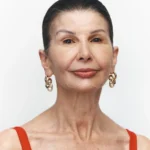 Wrinkles Schminkles Mouth & Lip Wrinkle Patches - Image 10