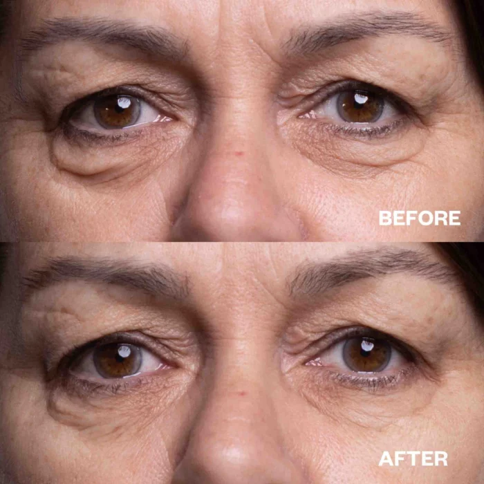 Wrinkles Schminkles Eye Wrinkle Patches - Image 5
