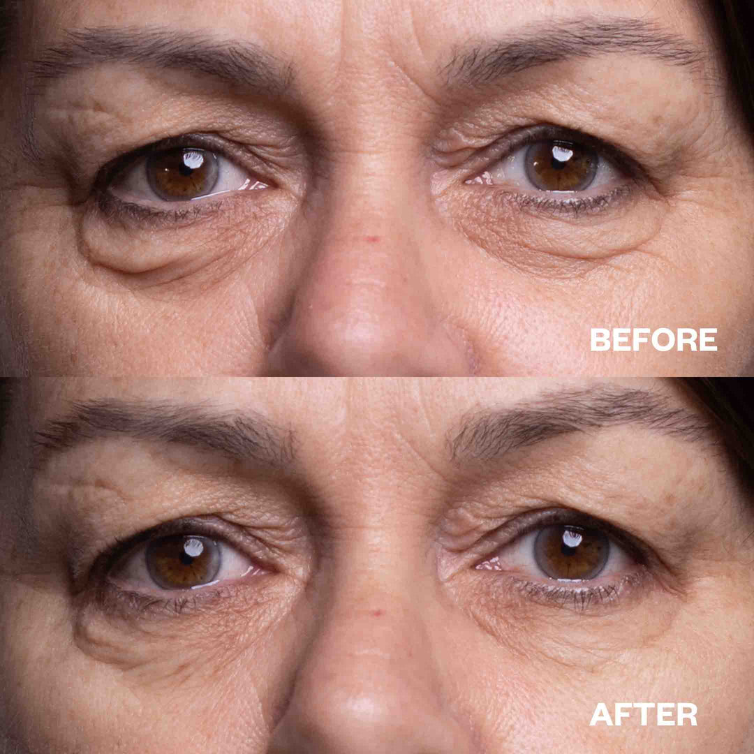 under-eyewrinkles-silicone-eye-pads-before-and-after-results-085870a8-6662-4fdc-b941-736ef80d47c4 Wrinkles Schminkles Eye Wrinkle Patches - Image 5