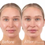 EltaMD UV Daily Hydration + SPF 50 - Image 7