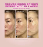 Murad Heartleaf Gentle Resurfacing Serum - Image 9