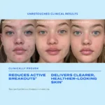 Murad Biome-Balancing Clear & Prevent Acne Treatment Serum - Image 8