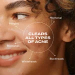 Murad Biome-Balancing Clear & Prevent Acne Treatment Serum - Image 10