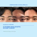 Murad Biome-Balancing Clear & Prevent Acne Treatment Serum - Image 9