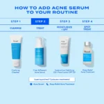 Murad Biome-Balancing Clear & Prevent Acne Treatment Serum - Image 5
