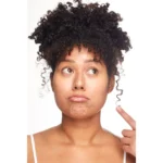 Patchology Breakout Box 3-In-1 Acne Treatment Kit - Image 3