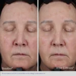 Obagi ELASTIderm Lift Up & Sculpt Moisturizer - Image 5