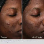 Obagi RETINOL Retinol + PHA - Image 5