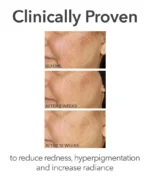 Dr Dennis Gross Bring The Clinic Home - DermInfusions™ Discovery Kit ($77 value) - Image 5