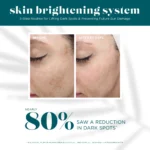 VI Derm Skin Brightening System - Image 3