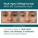 VI Derm Dark Spot Lifting Serum with 5% Tranexamic Acid - Image 7