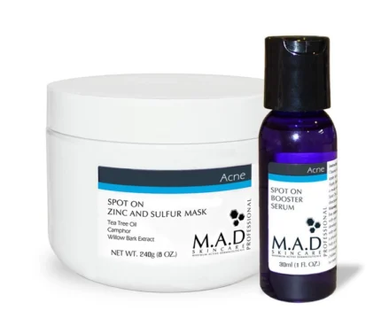 MAD Skincare Spot On Zinc and Sulfur Mask PRO