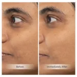 INVITY Youth Activating Instant Filler V2 - Image 5